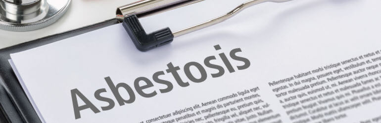 asbestosis