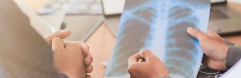 two people discussing an x ray that shows lung cancer at a table
