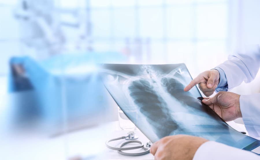 doctor examining lungs xray